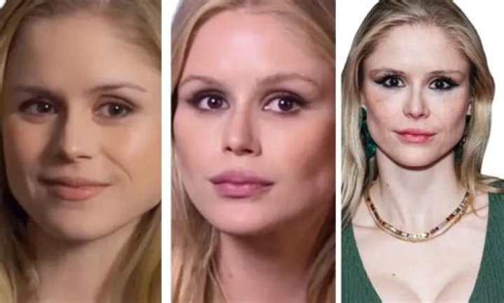 Erin Moriarty Before And After Plastic Surgery Her Transformation Journey