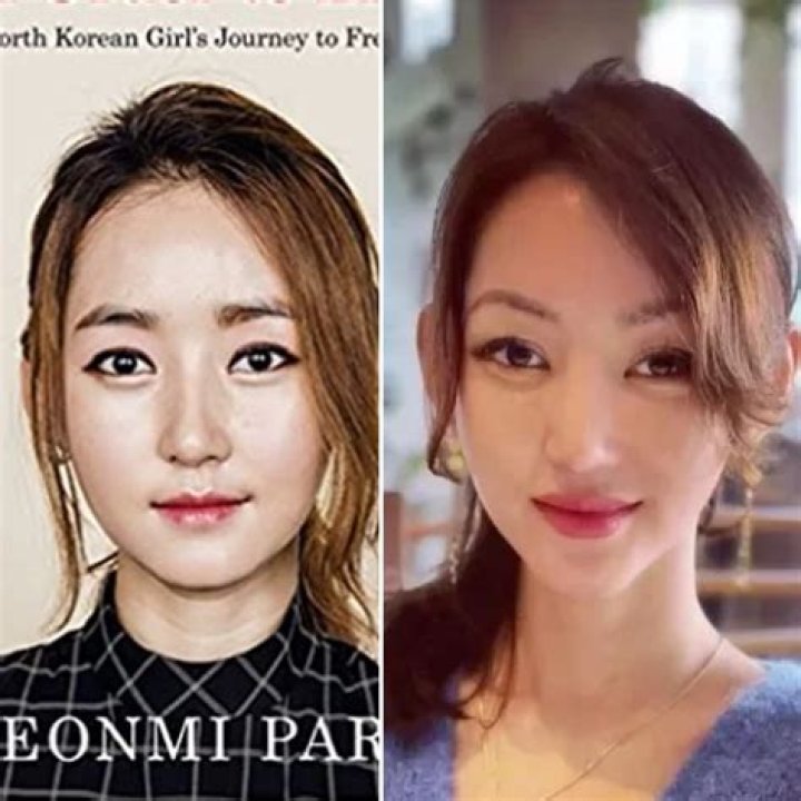 Park Yeonmi's Plastic Surgery Journey: Uncovering The Transformation