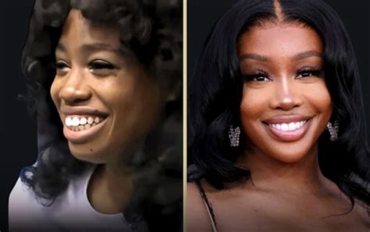 SZA Confirms the Plastic Surgery Procedure She&rsquo;s Had Done, Explains Why