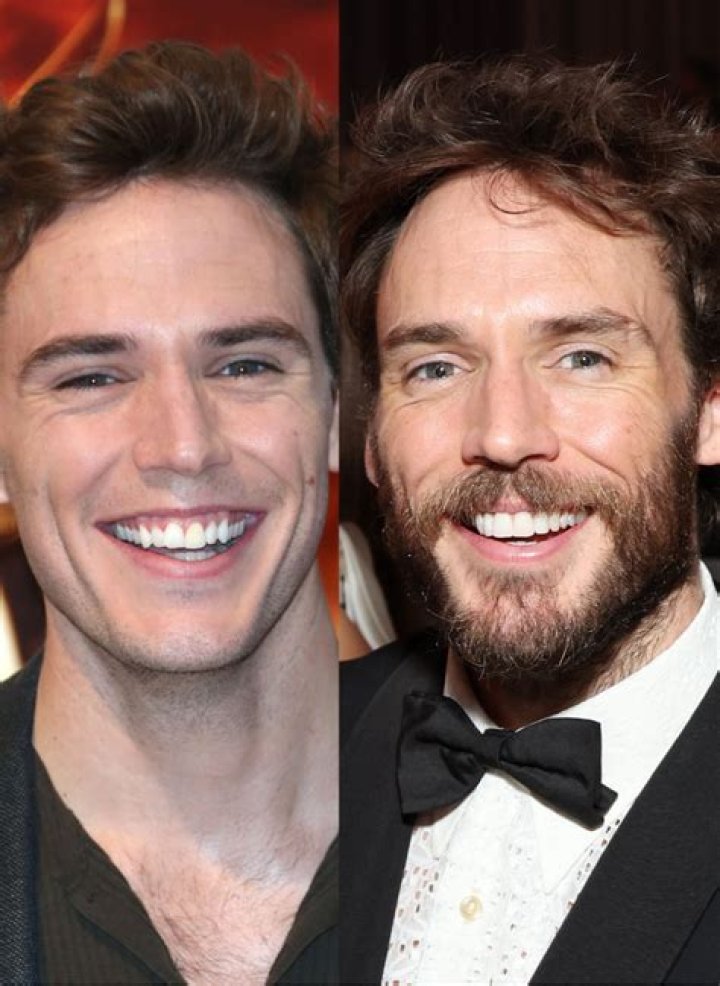 Uncover The Secrets Of Sam Claflin's Radiant Smile: The Power Of Veneers