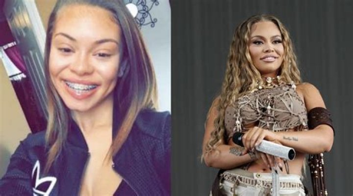Unveiling Latto's Plastic Surgery Journey: Discoveries And Insights