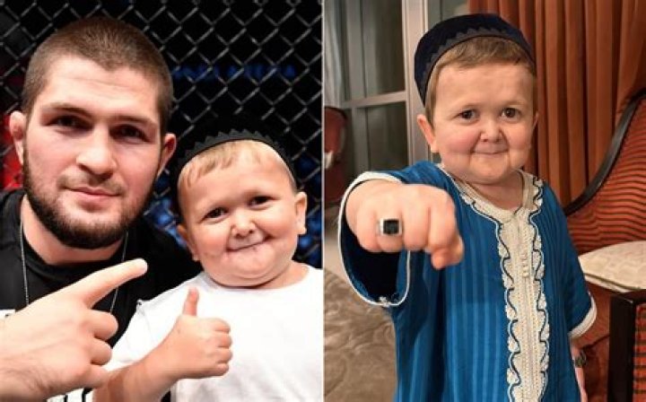 Unveiling The Extraordinary Life Of Hasbulla Magomedov: Disability, Inspiration, And Triumph
